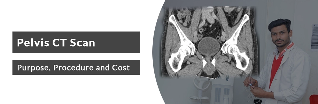 Pelvis CT Scan: Purpose, Procedure, Cost in Delhi/ Noida/ NCR